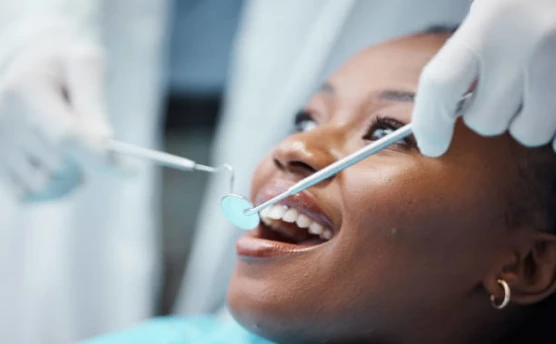 Ayuda dental: Opciones asequibles para tu bienestar